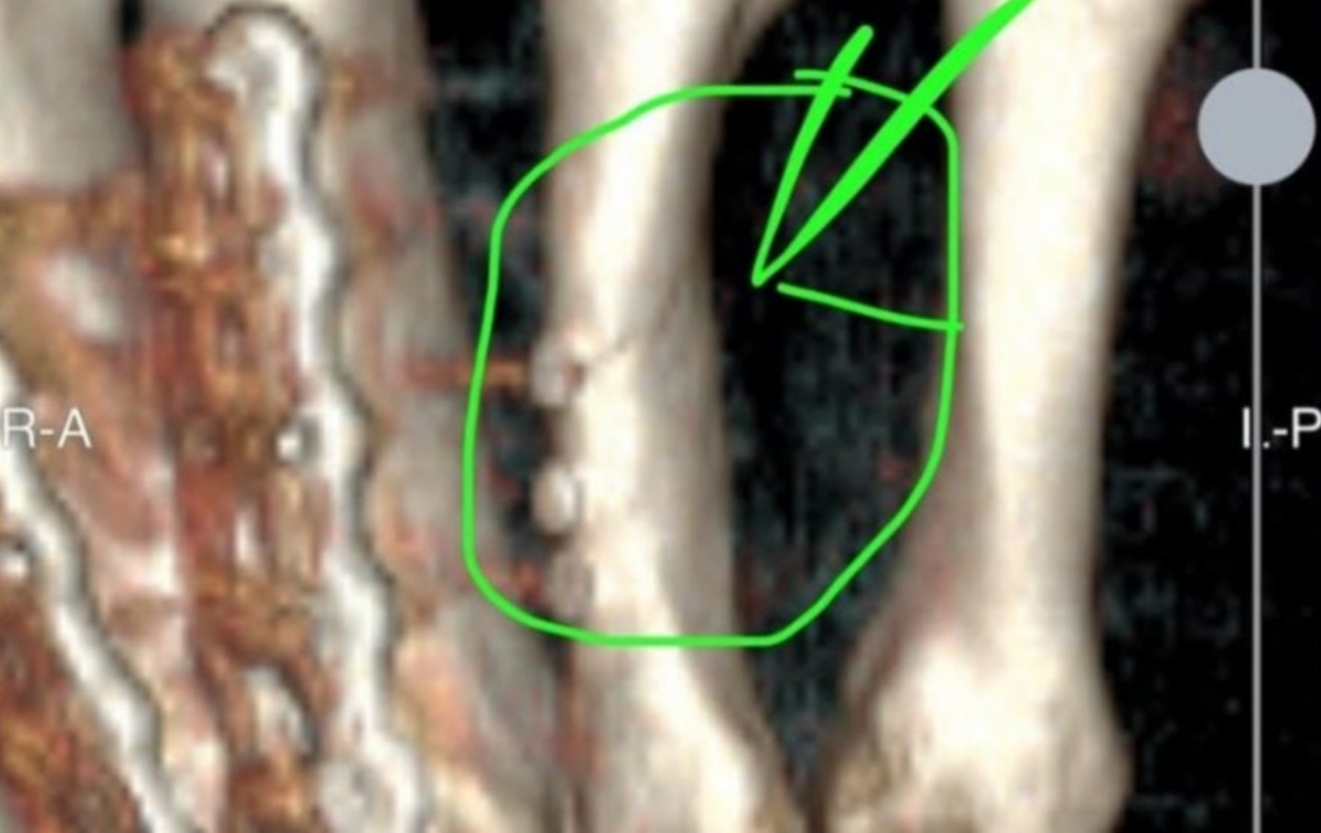 Новая травма Данило Петруччи Новая травма Данило Петруччи