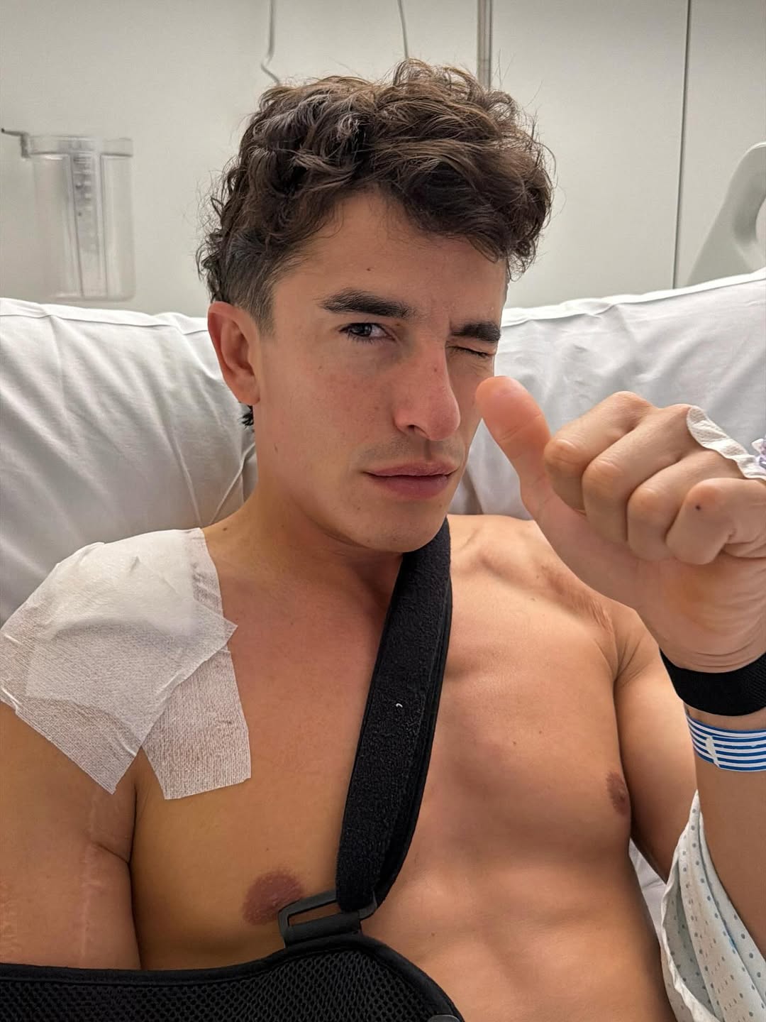 Марку Маркесу сделали новую операцию на правом плече Марку Маркесу сделали новую операцию на правом плече