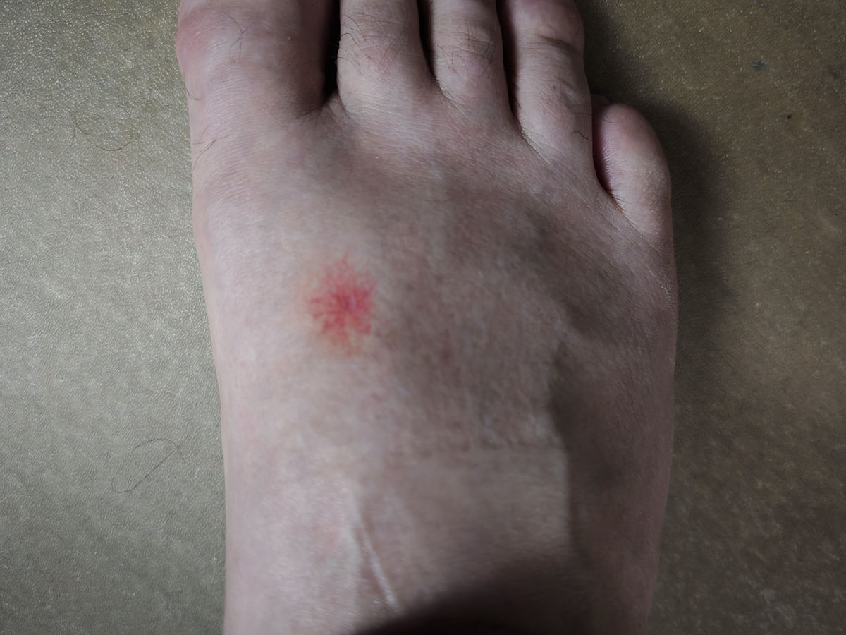 Мой случай Мой случай