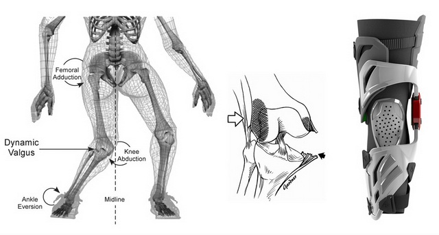 LEATT C-Frame: главное - защита коленного сустава