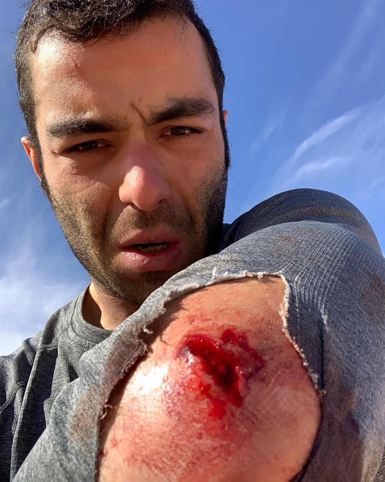 Данило Петруччи пробил локоть при падении на 3-м км СУ6