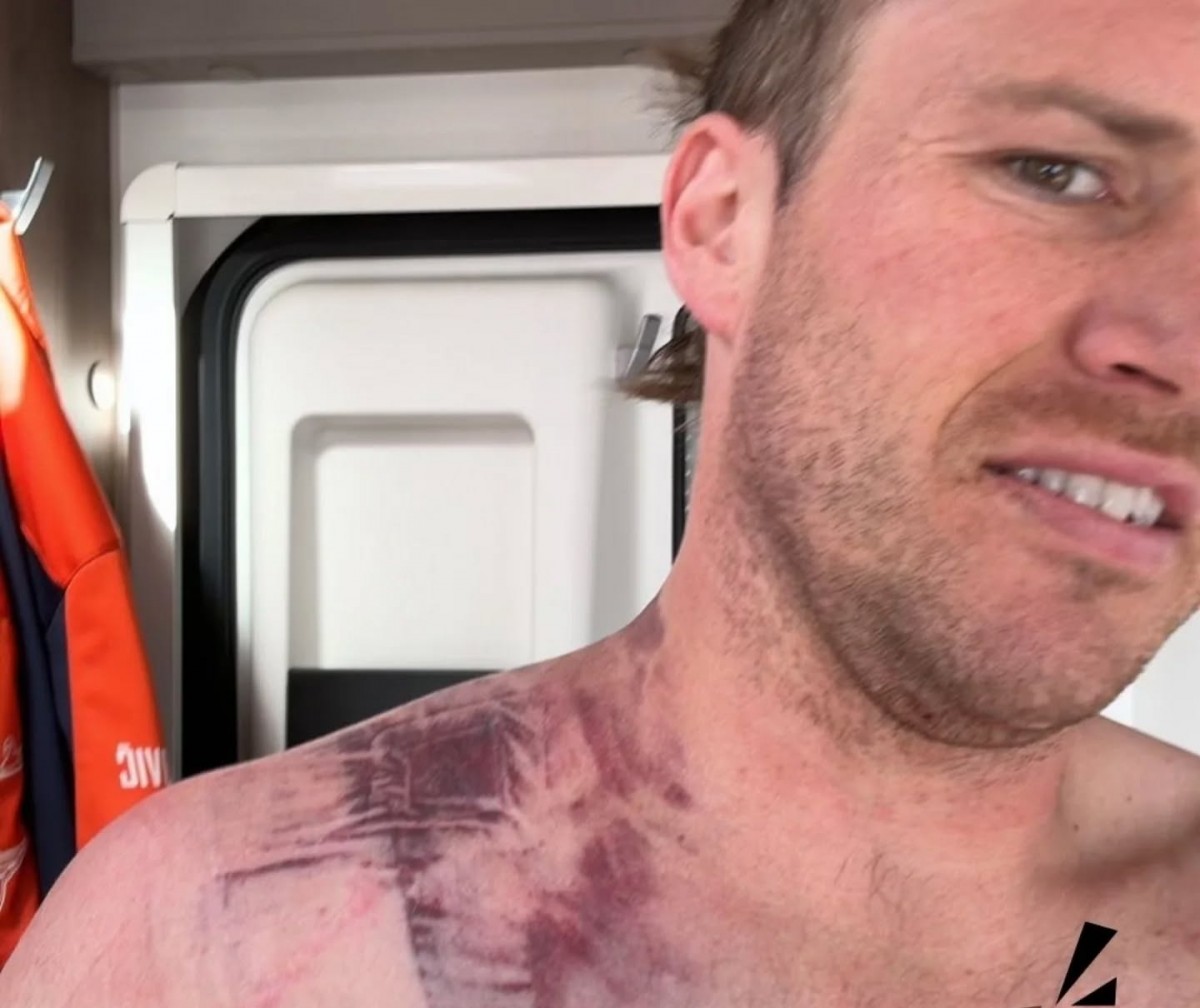 Даниэль Сандерс сломал ключицу при падении на СУ10