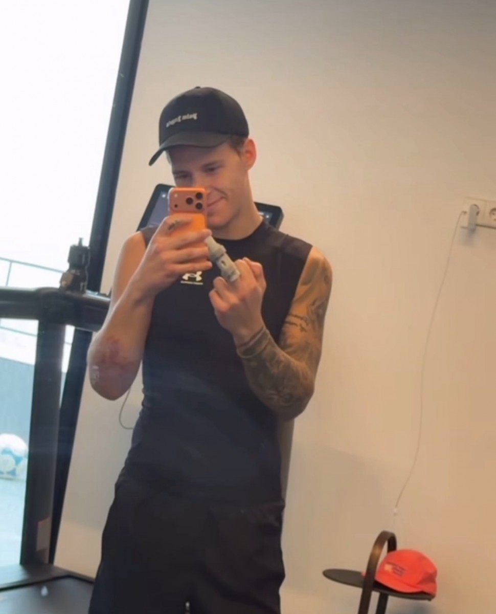 Фабио Куартараро прооперировали сломанный средний палец