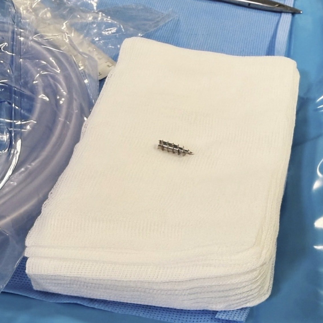 Вот это лишнее железо терзало Виньялеса с начала года